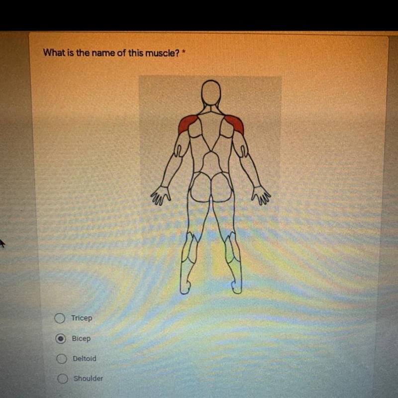 What is the name of this muscle?-example-1