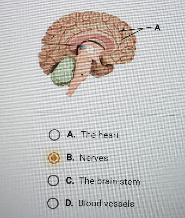 What does the structure labeled A represent in the model of the human brain below-example-1