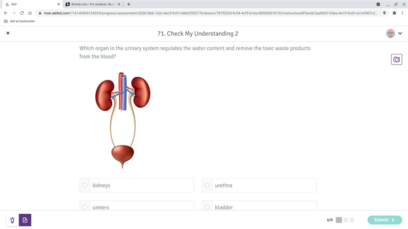 Which orgen in the urinary system regulates the water content and remove the toxic-example-1