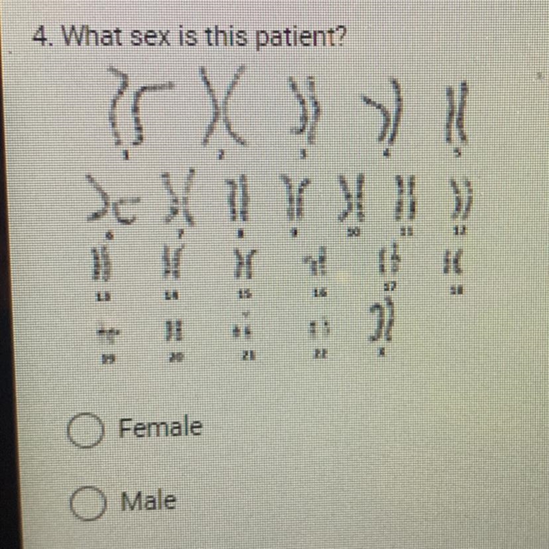 Biology 1/ Module 03: Division, Genetics, DNA4. What sex is this patient?-example-1