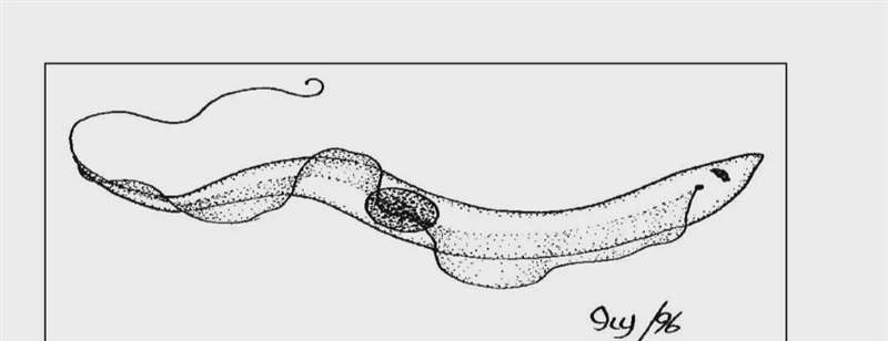 What disease does this parasite cause? What is its invertebrate host (vector/ intermediary-example-1