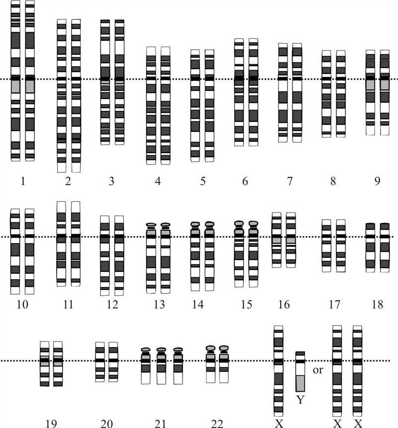 Use the following Karyotype to identify any genetic abnormalities in the subject.Karyotype-example-1