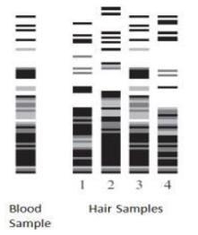 20. The diagram below shows the DNA fingerprints from a blood sample and four different-example-1