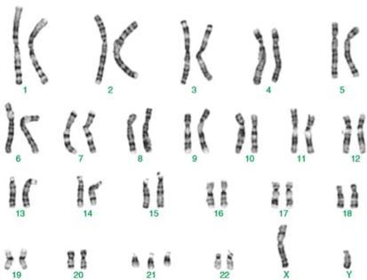 31. The family of this child is working with a geneticist to determine what condition-example-1