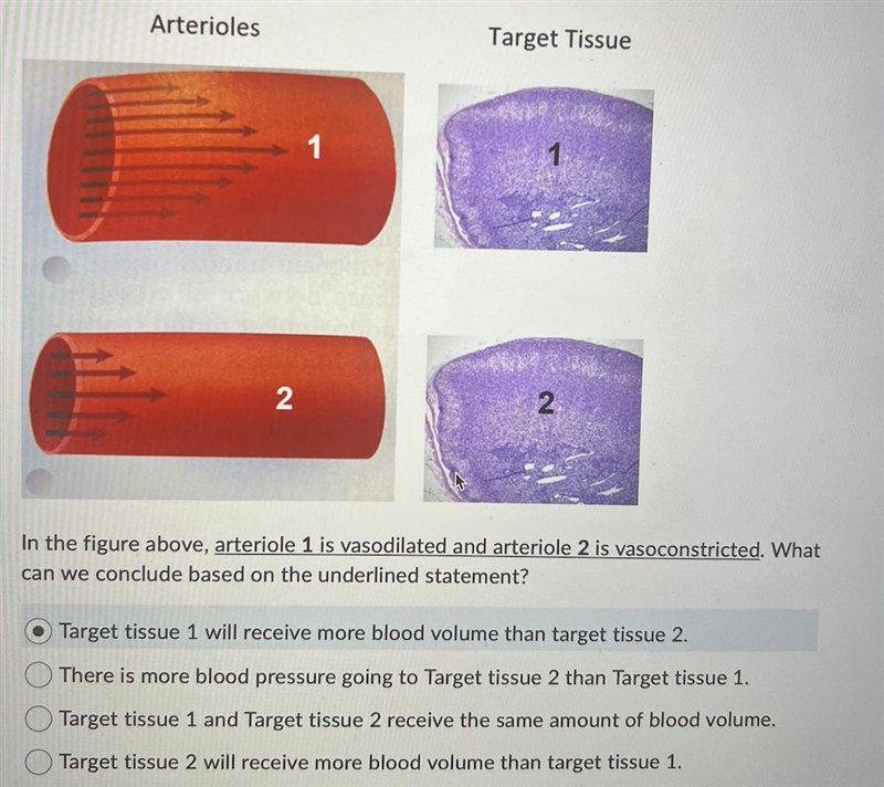 PLEASE HELP!! In the figure above, arteriole 1 is vasodilated and arteriole 2 is vasoconstricted-example-1