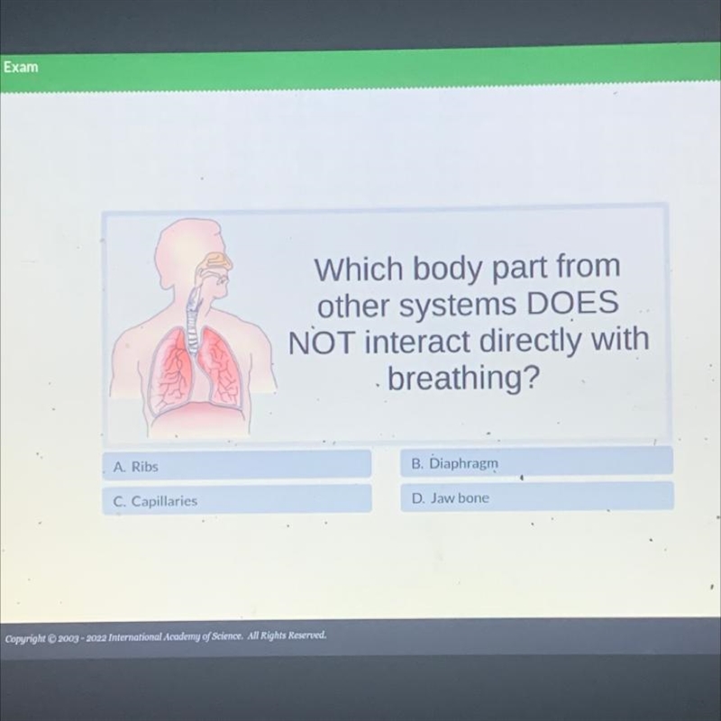 What’s the correct answer answer asap-example-1