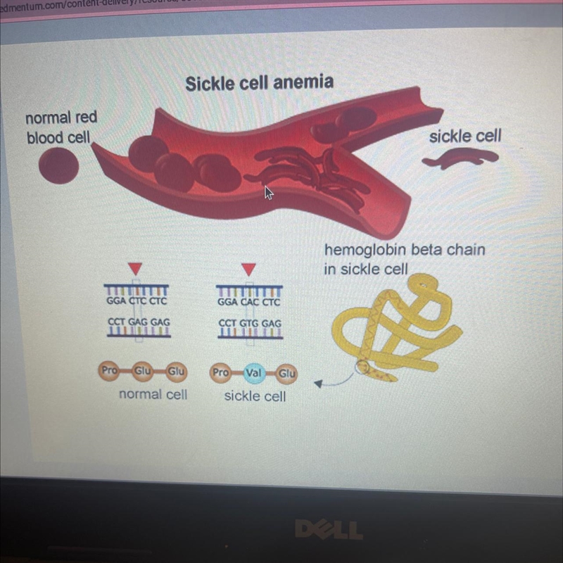 Explain how the mutation in the DNA sequence affects protein synthesis-example-1