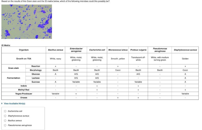 Based on the results of this Gram stain and the ID matrix below, which of the following-example-1