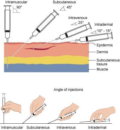 Explain the difference between intravenous, intramuscular and subcutaneous injections-example-1