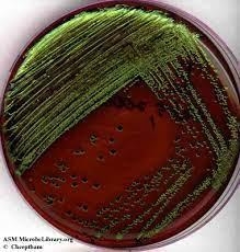 Is this a E. coli from a EMB media? I’m not sure-example-1