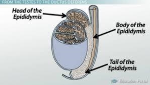 Where is the Epididymis-example-2