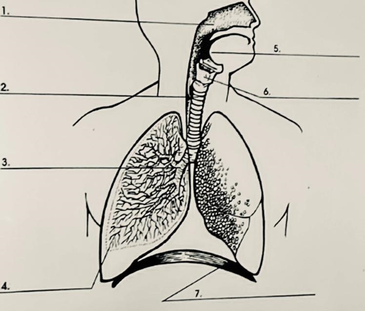 Label the structures in the following image- pharynx- bronchial tube- lung- diaphragm-example-1