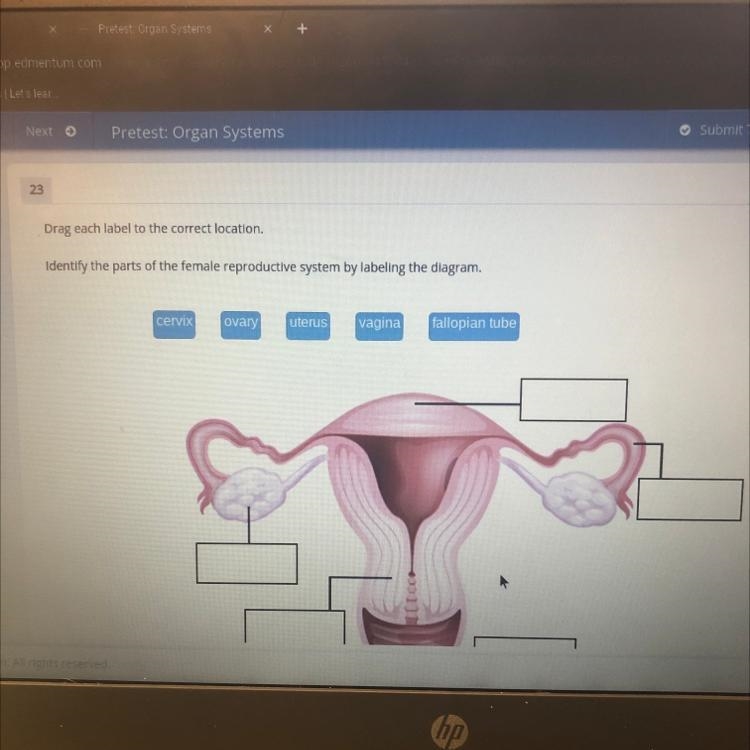 ￼identify the part of the female reproductive system by lebeling the diagram.-example-1