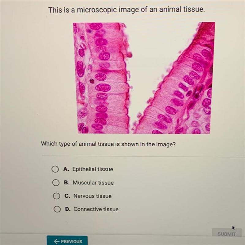 This is a microscopic image of an animal tissue. Which type of animal tissue is shown-example-1