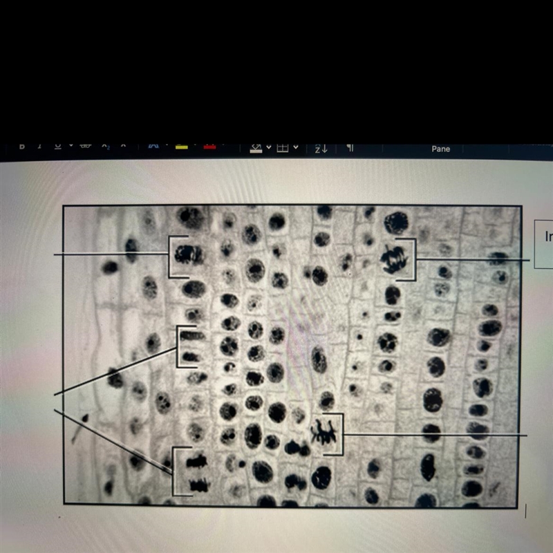 How many cells are in interphase, how many in prophase, how many in metaphase, anaphase-example-1