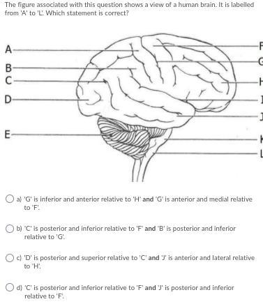 The figure associated with this question shows a view of a human brain. It is labelled-example-1