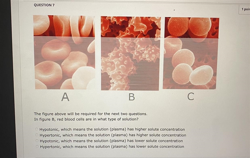 The figure above will be required for the next two questionsIn figure B, red blood-example-1