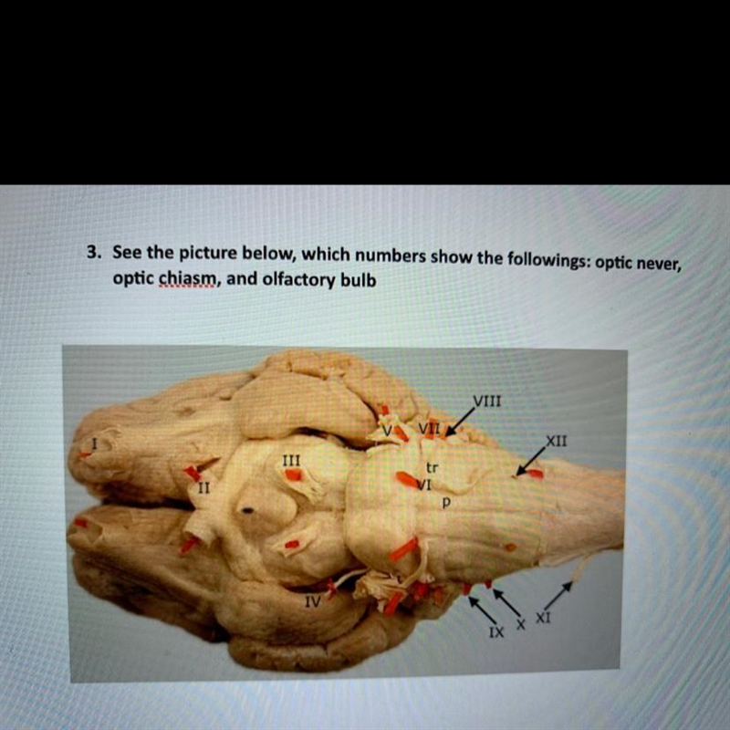 3. See the picture below, which numbers show the followings: optic never,optic chiasm-example-1