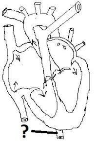 Identify the part of the heart.A) AortaB) Inferior vena cavaC) Superior vena cavaD-example-1