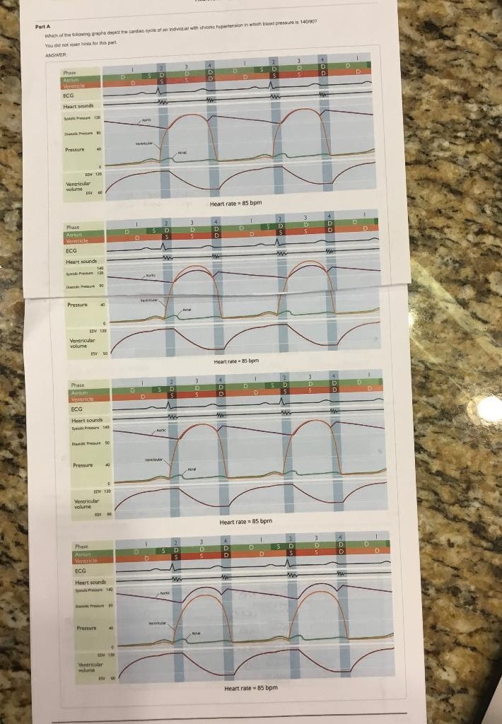 which of the following graphs depict the cardiac cycle of an individual with chronic-example-1