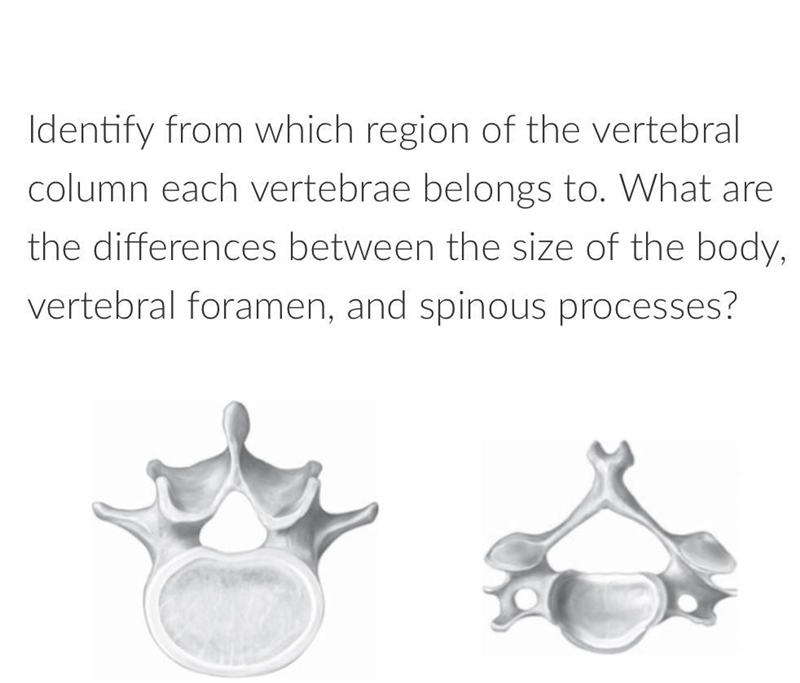 Identify from which region of the vertebral column each vertebrae belongs to. What-example-1