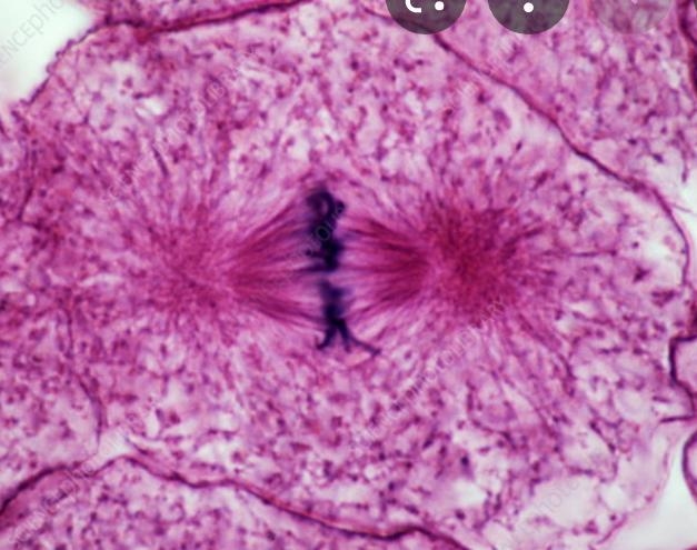 The image below is in what stage of the cell cycle?-example-1