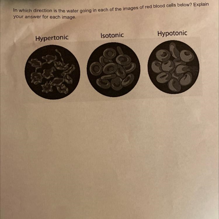 In which direction is the water going in each of the images of red blood cells below-example-1