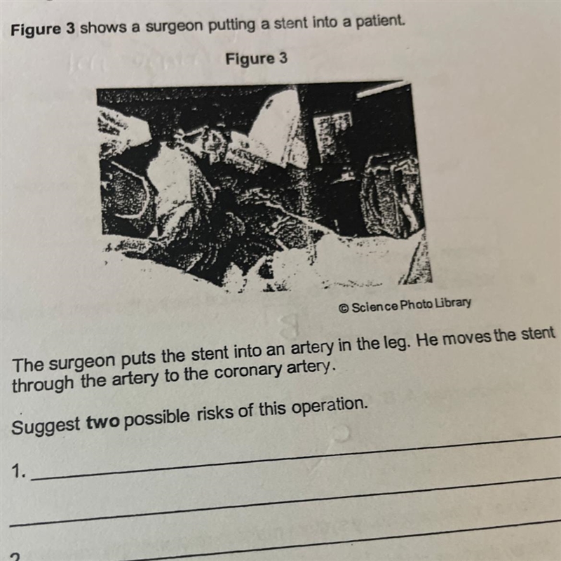 What are the risks of the operation when the stent goes through the artery to the-example-1