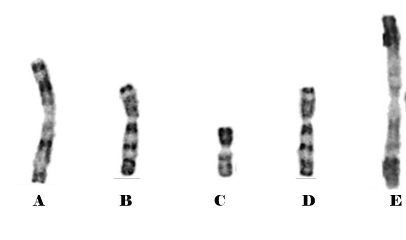 Which pair are homologous chromosomes? PLLZZZZ-example-1