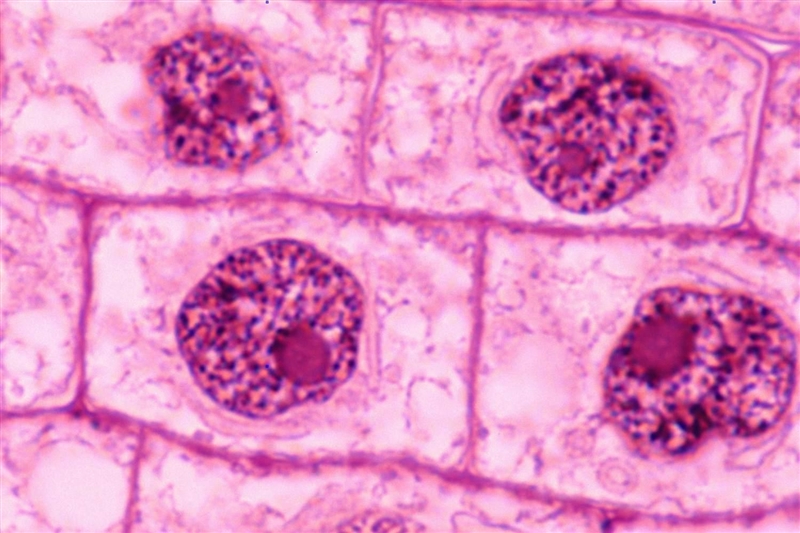 Can someone help me finding real images for Interphase?-example-1