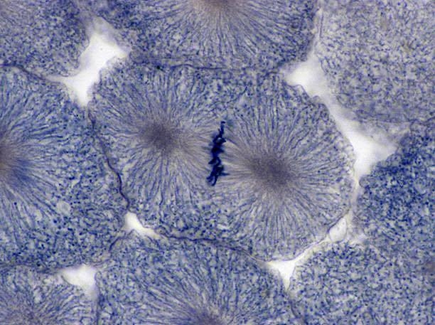 Can someone help me find real images for Metaphase?-example-2