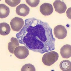 What is the largest leukocyte that contains small cytoplasmic granules and typically-example-1