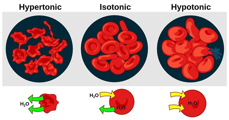 Explain why transfusion with distilled water is not recommended for a dehydrated patient-example-1