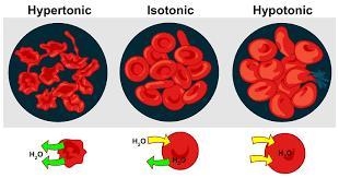 Diagram of hypertonic and hypotonic solution ​-example-1