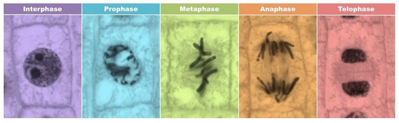 I need help finding real life images of both prophase and interphase. I end up mixing-example-1