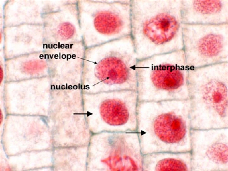 Can someone help me finding real images for Interphase?-example-3