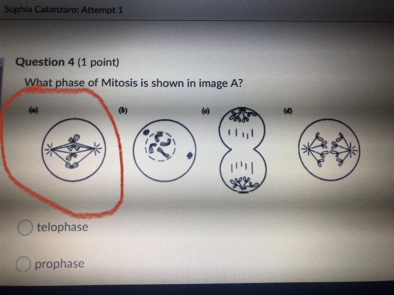 What phase of Mitosis is shown in Image A?-example-1