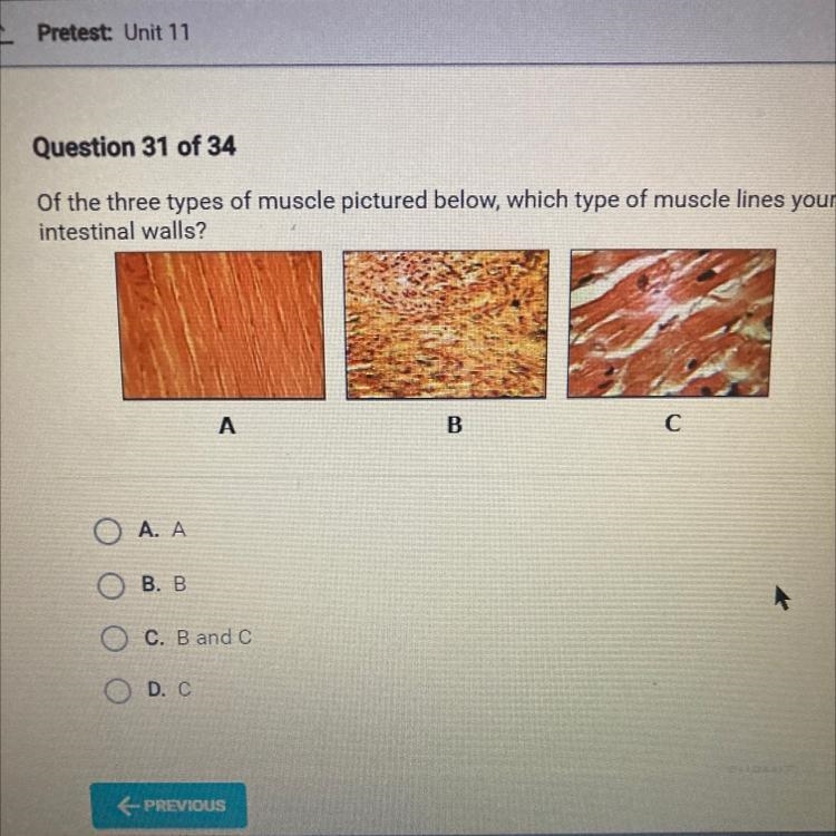 Question 31 of 34 Of the three types of muscle pictured below, which type of muscle-example-1