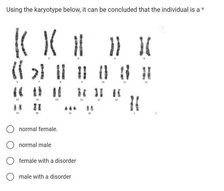 Using the karyotype below, it can be concluded that the individual is a-example-1