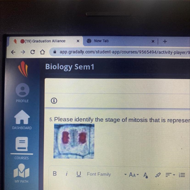 What is the stage of mitosis is represented in the picture-example-1