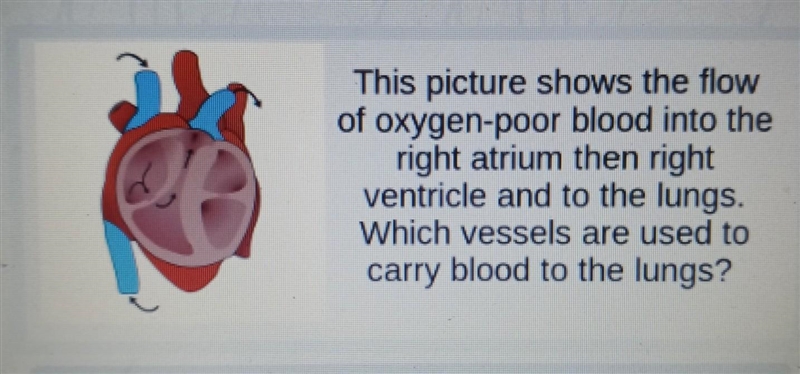 This picture shows the flow of oxygen-poor blood into the right atrium then right-example-1