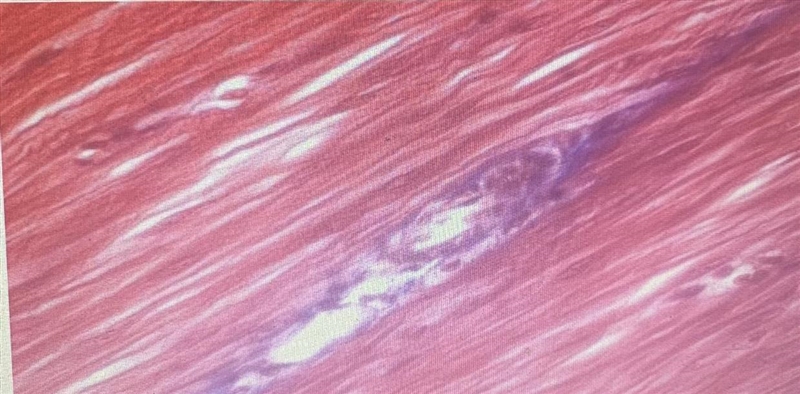 What type of tissue is this? What characteristics helped you decide the type of tissue-example-1