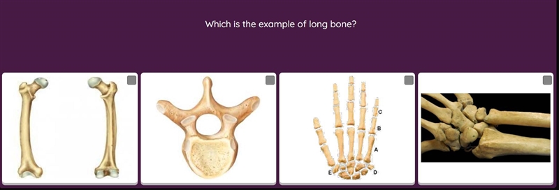 Pls help. Which is the example of long bone?-example-1