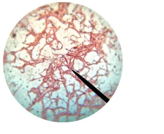 After doing an endospore staining procedure on an unknown bacteria, you looked at-example-1