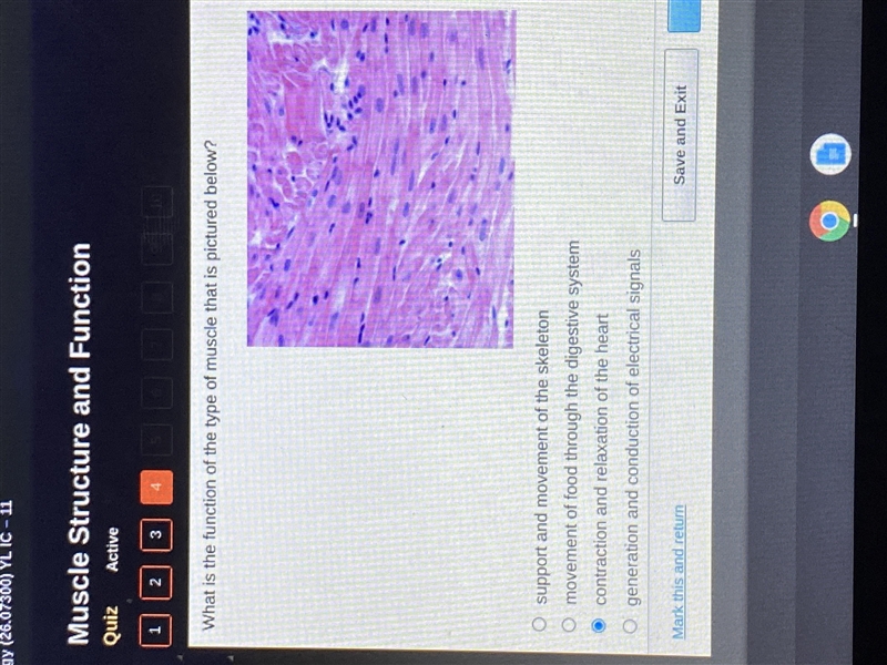 What is the function of the type of muscle that is pictured below?-example-1