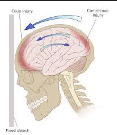 2) __________ lesions often occur with direct injury such as is incurred from a direct-example-1