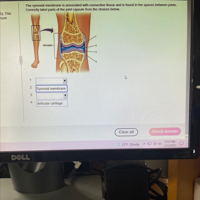 Help please . The synovial membrane is associated with connective tissue and is found-example-1