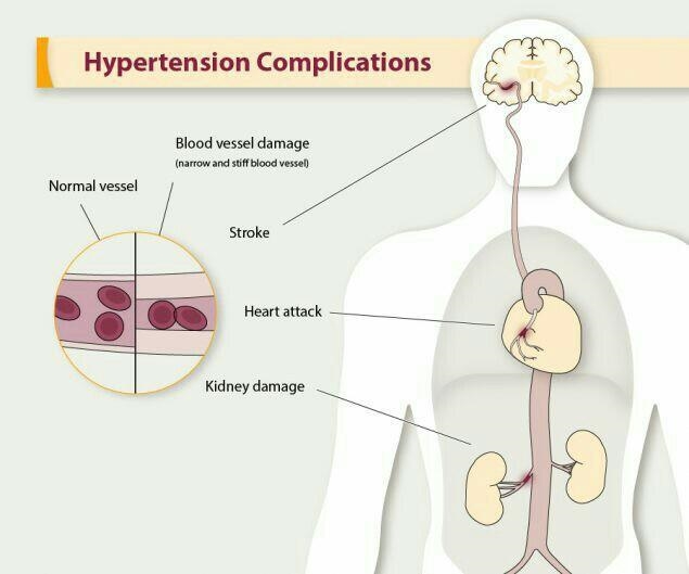 What is the range for hypertension or high blood pressure?-example-1