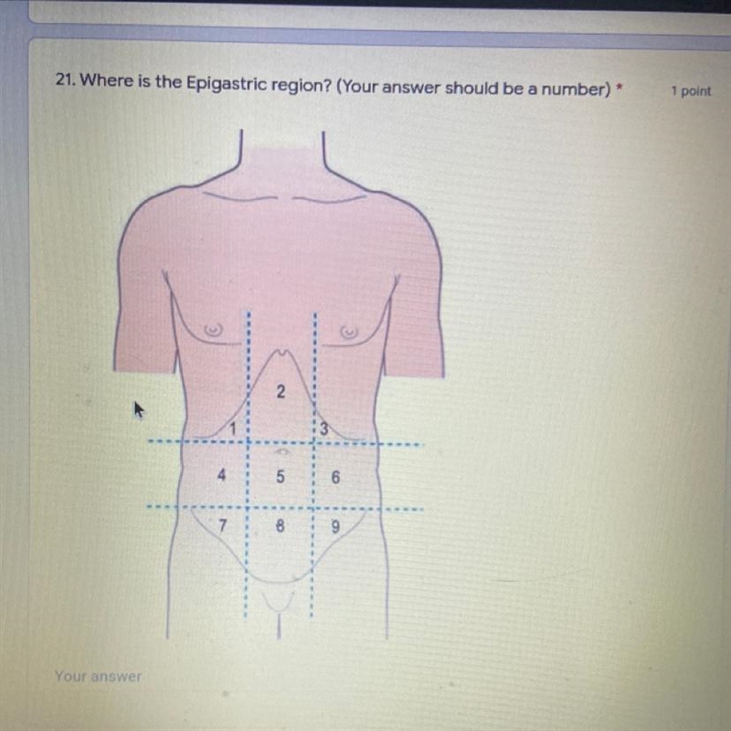 Where is the epigastric region? your answer should be a number-example-1