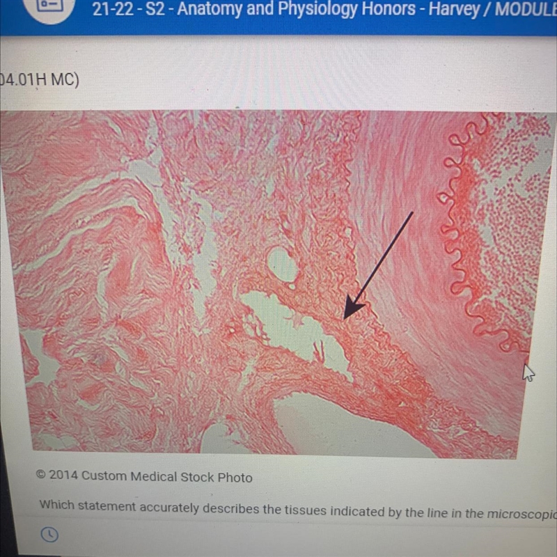 HELP! ASAP Which statement accurately describes the tissues indicated by the line-example-1